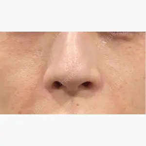 美容皮膚科エルムクリニック 岡山院口コミ