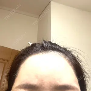 アムルーズ美容外科クリニック 大阪院口コミ
