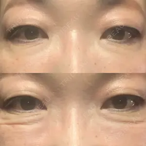 湘南美容クリニック 名古屋栄院口コミ