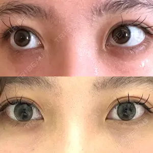 BELINDA CLINIC（ベリンダクリニック）新宿院口コミ