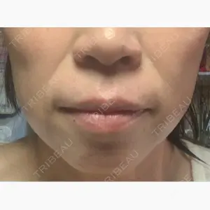 湘南美容クリニック 名古屋栄院口コミ