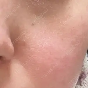 クリニックゼロプラス口コミ
