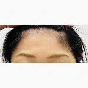 TCB東京中央美容外科 青森院口コミ