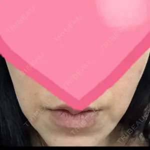X CLINIC 大阪院口コミ