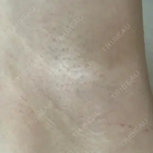 湘南美容クリニック 仙台院口コミ