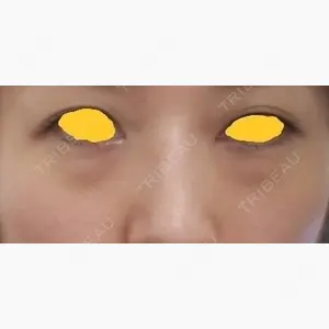 韓国ST美容整形外科口コミ