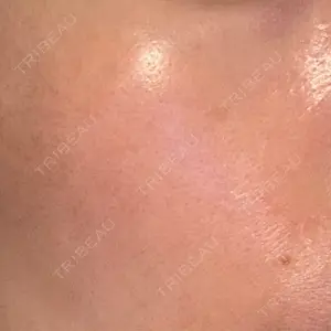 美容皮膚科エルムクリニック 広島院口コミ