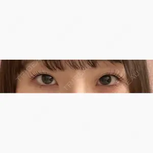 LUHO（ルホ）美容外科口コミ