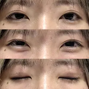 プロミス整形外科口コミ