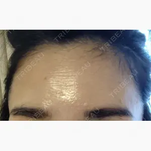 品川スキンクリニック岡山院口コミ