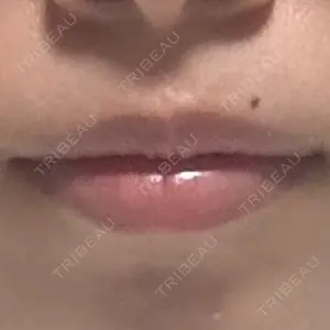 栄美容クリニック 栄院口コミ