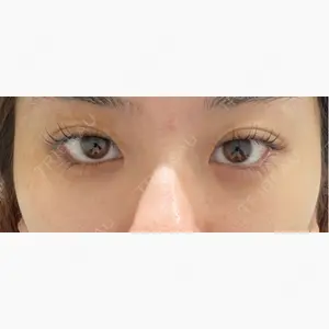 BIANCA表参道口コミ