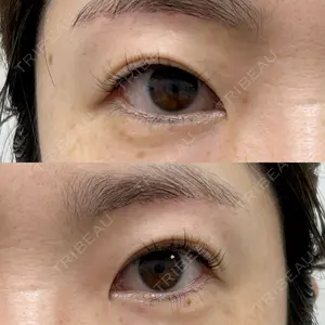 湘南美容クリニック 西葛西院口コミ