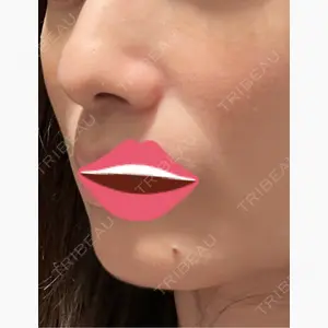 お茶の水美容形成クリニック口コミ