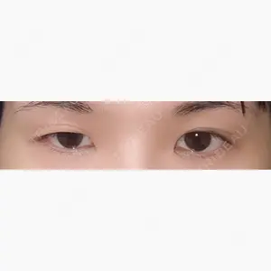 LUHO（ルホ）美容外科口コミ