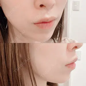 エターナル美容クリニック口コミ