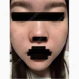 Floraエイジングケアクリニック口コミ