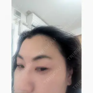 TCB東京中央美容外科 松山院口コミ