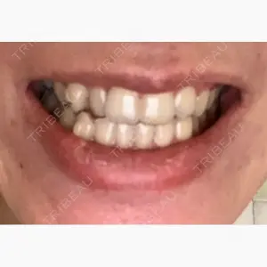 赤坂さくら歯科クリニック口コミ