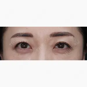 川越TAクリニックアソシエ口コミ