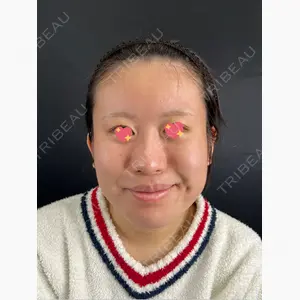 藤・ナチュレ美容クリニック 銀座院口コミ