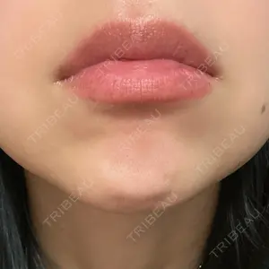 一宮美容クリニック口コミ