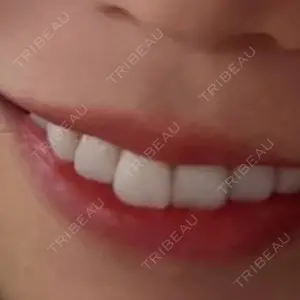 目黒まついデンタルクリニック口コミ