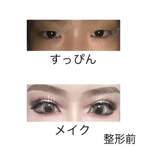 大阪梅田中央クリニック美容外科口コミ