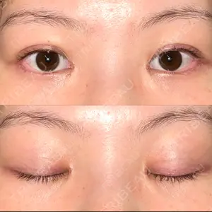 メディカルアートメイク大阪口コミ