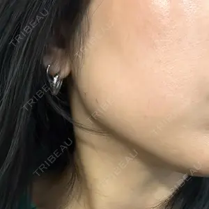 一宮美容クリニック口コミ