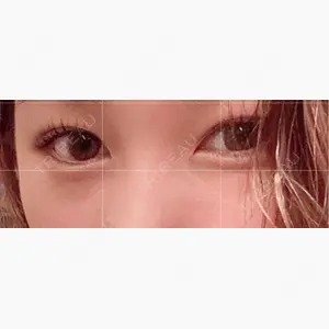 CHARIS BEAUTY CLINIC口コミ