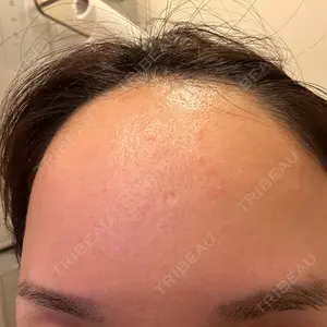 TCB東京中央美容外科 北千住院口コミ