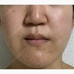 東京美容クリニック 表参道本院口コミ