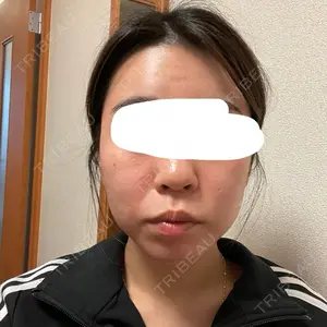 きれいクリニック口コミ