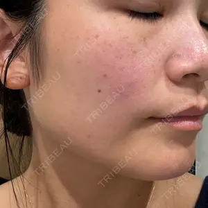 X CLINIC 大阪院口コミ