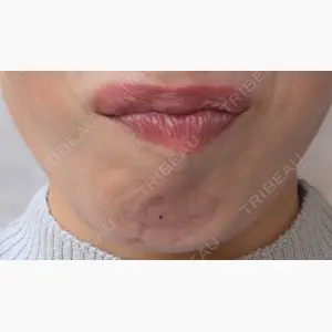 Natural Skin Clinic 笹塚院口コミ