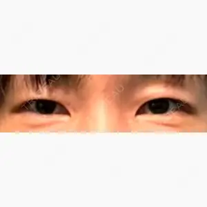 広島プルミエクリニック口コミ