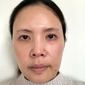 ルーチェクリニック 銀座院口コミ