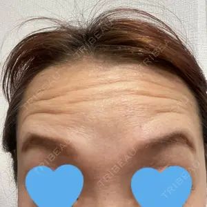 TCB東京中央美容外科 北千住院口コミ