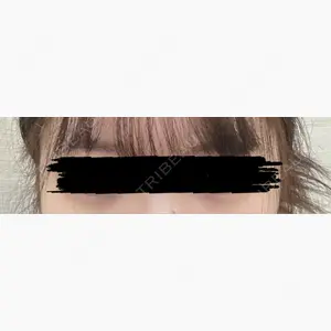 フィラークリニック 札幌院口コミ