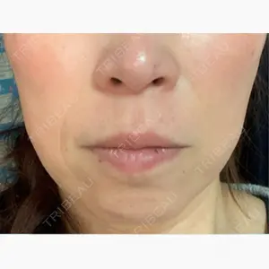 栄美容クリニック 栄院口コミ