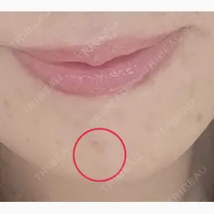 湘南美容クリニック 仙台院口コミ