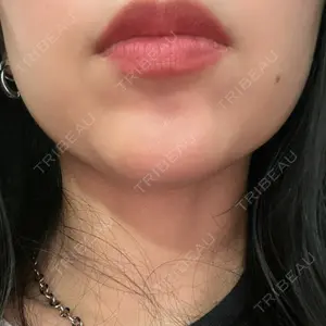 一宮美容クリニック口コミ