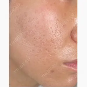 藤・ナチュレ美容クリニック 銀座院口コミ