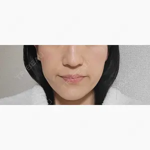 X CLINIC 大阪院口コミ