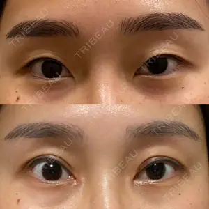 LUHO（ルホ）美容外科口コミ