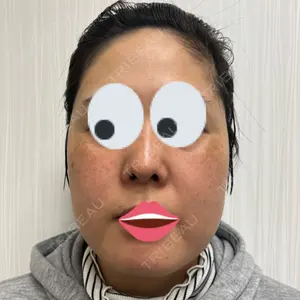 アスク美容クリニック銀座口コミ