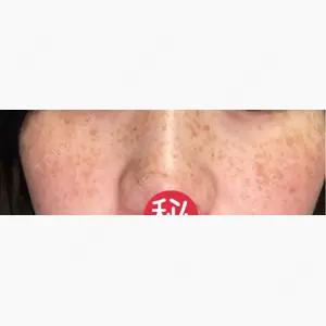 MIO CLINIC 梅田院口コミ