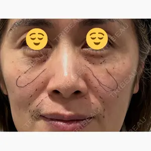 X CLINIC 大阪院口コミ