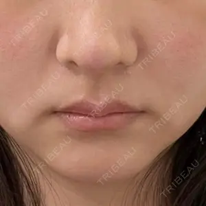 あいちビューティークリニック口コミ